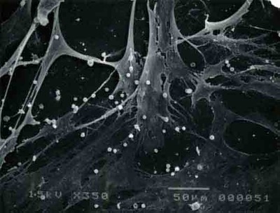 osteoblastes et leucocytes PRF site